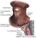 thyroid.jpg